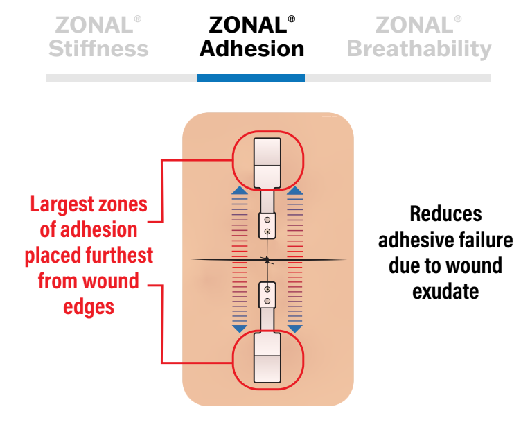 ZONAL® Adhesion diagram — the largest zones of adhesion are placed furthest from the wound edges, reducing adhesive failure due to wound exudate.