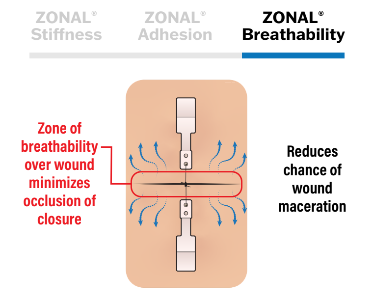 ZONAL® Breathability diagram — a zone of breathability over the wound minimizes occlusion of the closure, reducing the chance of wound maceration.